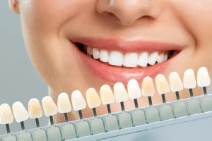 Introdução Um sorriso impecável é uma parte essencial da nossa autoconfiança e bem-estar. No entanto, muitas pessoas enfrentam imperfeições dentárias que podem afetar sua autoestima. Felizmente, as lentes de contato dental oferecem uma solução eficaz para corrigir uma variedade de problemas dentários e transformar completamente o sorriso. Neste post, vamos explorar como as lentes de contato dental podem corrigir imperfeições dentárias e ajudar você a alcançar um sorriso verdadeiramente impecável. Índice 1. O que são as lentes de contato dental? 2. Como as lentes de contato dental corrigem imperfeições dentárias? 3. Quais imperfeições dentárias podem ser corrigidas com as lentes de contato dental? 4. Vantagens das lentes de contato dental em comparação com outras opções de tratamento. 5. Agende uma consulta para transformar seu sorriso com as lentes de contato dental. 1. O que são as lentes de contato dental? As lentes de contato dental são finas camadas feitas de porcelana ou resina, projetadas para serem aplicadas sobre a superfície dos dentes naturais. Elas são personalizadas para se encaixarem perfeitamente nos dentes, corrigindo imperfeições estéticas e proporcionando um sorriso mais bonito e harmonioso. 2. Como as lentes de contato dental corrigem imperfeições dentárias? As lentes de contato dental funcionam cobrindo as imperfeições dos dentes naturais. Elas podem corrigir manchas, descolorações, espaçamentos irregulares, dentes desalinhados e até mesmo mudanças no formato dos dentes, resultando em um sorriso mais uniforme e atraente. 3. Quais imperfeições dentárias podem ser corrigidas com as lentes de contato dental? As lentes de contato dental podem corrigir uma ampla variedade de imperfeições dentárias, incluindo manchas causadas por medicamentos ou tabagismo, descolorações, espaçamentos irregulares, dentes desalinhados, dentes pequenos ou malformados, entre outros problemas estéticos. 4. Vantagens das lentes de contato dental em comparação com outras opções de tratamento As lentes de contato dental oferecem uma série de vantagens em comparação com outras opções de tratamento, incluindo resultados instantâneos, durabilidade, resistência a manchas e uma aparência natural. Além disso, elas exigem menos desgaste dos dentes naturais em comparação com outras opções, como coroas dentárias ou facetas. 5. Agende uma consulta para transformar seu sorriso com as lentes de contato dental Se você está insatisfeito com a aparência dos seus dentes e deseja alcançar um sorriso impecável, as lentes de contato dental podem ser a solução que você procura. Agende uma consulta com a Dra. Tânia Siqueira hoje mesmo e descubra como as lentes de contato dental podem corrigir imperfeições dentárias e ajudá-lo a alcançar um sorriso verdadeiramente impecável.