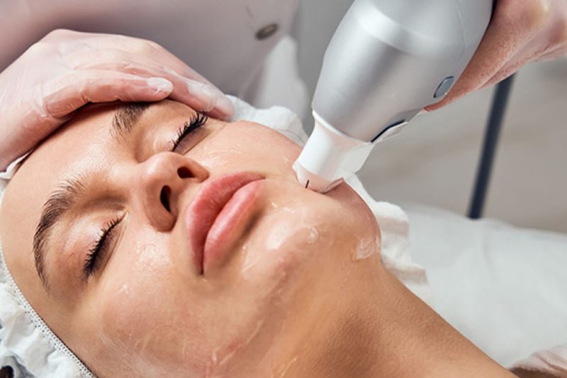 Ultraformer 3 para flacidez facial: Resultados comprovados?