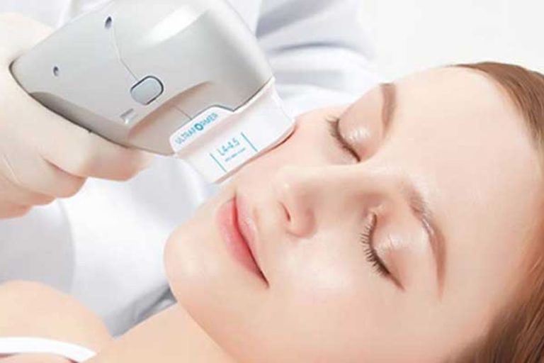 Ultraformer 3 para lifting facial Uma alternativa à cirurgia